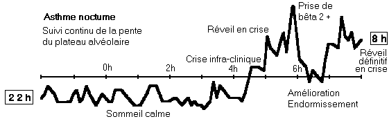 Evolution de S2 durant un enregistrement nocturne