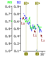 Trends of 2 capnographic indices