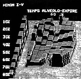 Vidange alv&eacute;olaire lors d'un bronchospasme