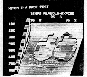 Vidange alv&eacute;olaire normale